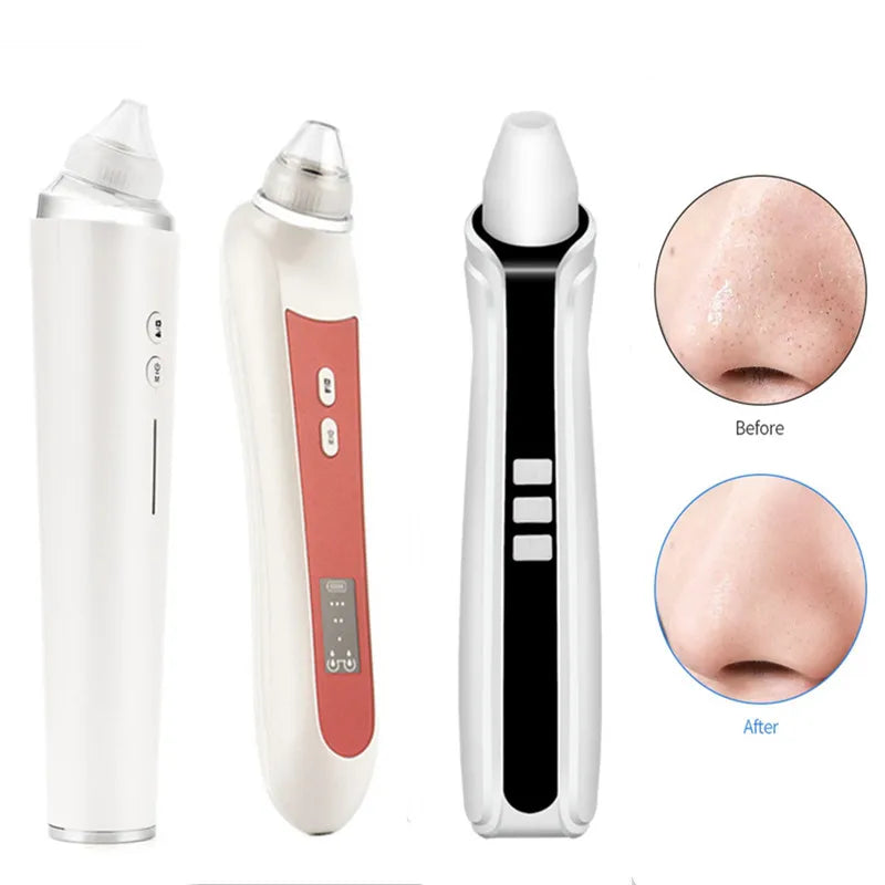 Vacuum Suction Deep Cleansing Electric Facial Pore Cleaner