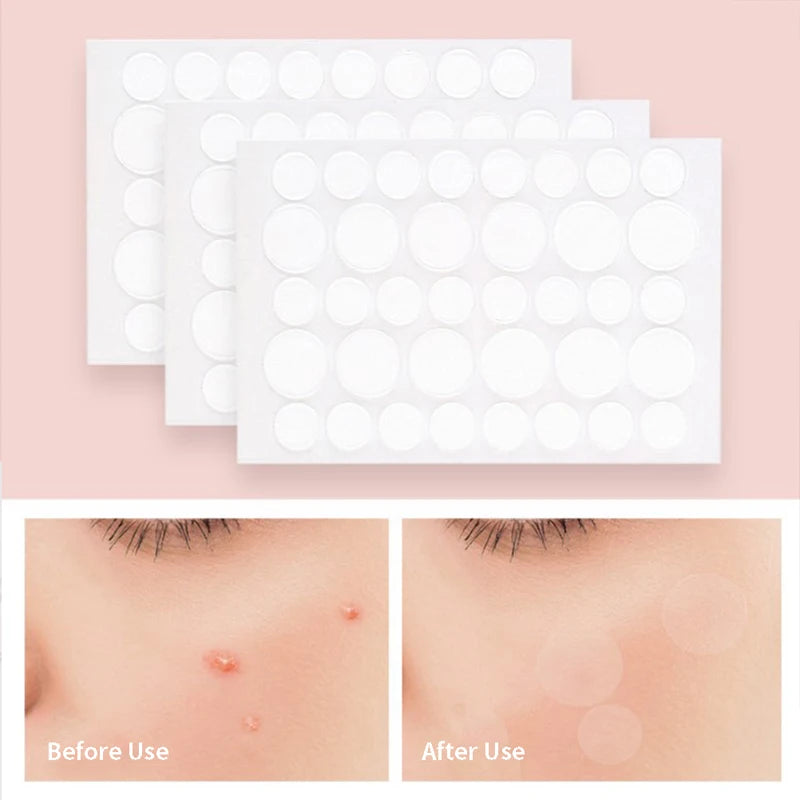 Invisible Waterproof Acne Pimple Patch